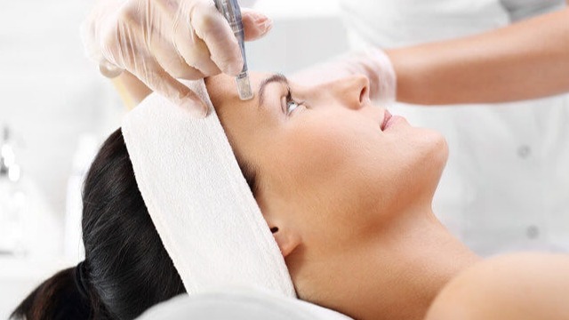 Microneedling
